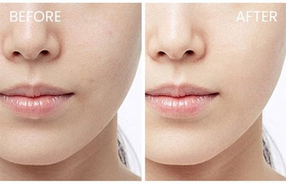 SKIN1004 Madagascar Centella Hyalu-Cica Cloudy Mist - 120ml