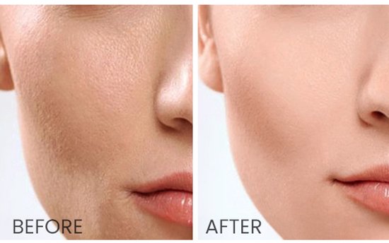 SKIN1004 Madagascar Centella Toning Toner - 210ml